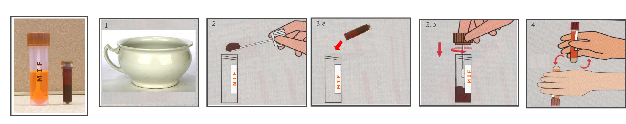 Parasitos en heces pdf