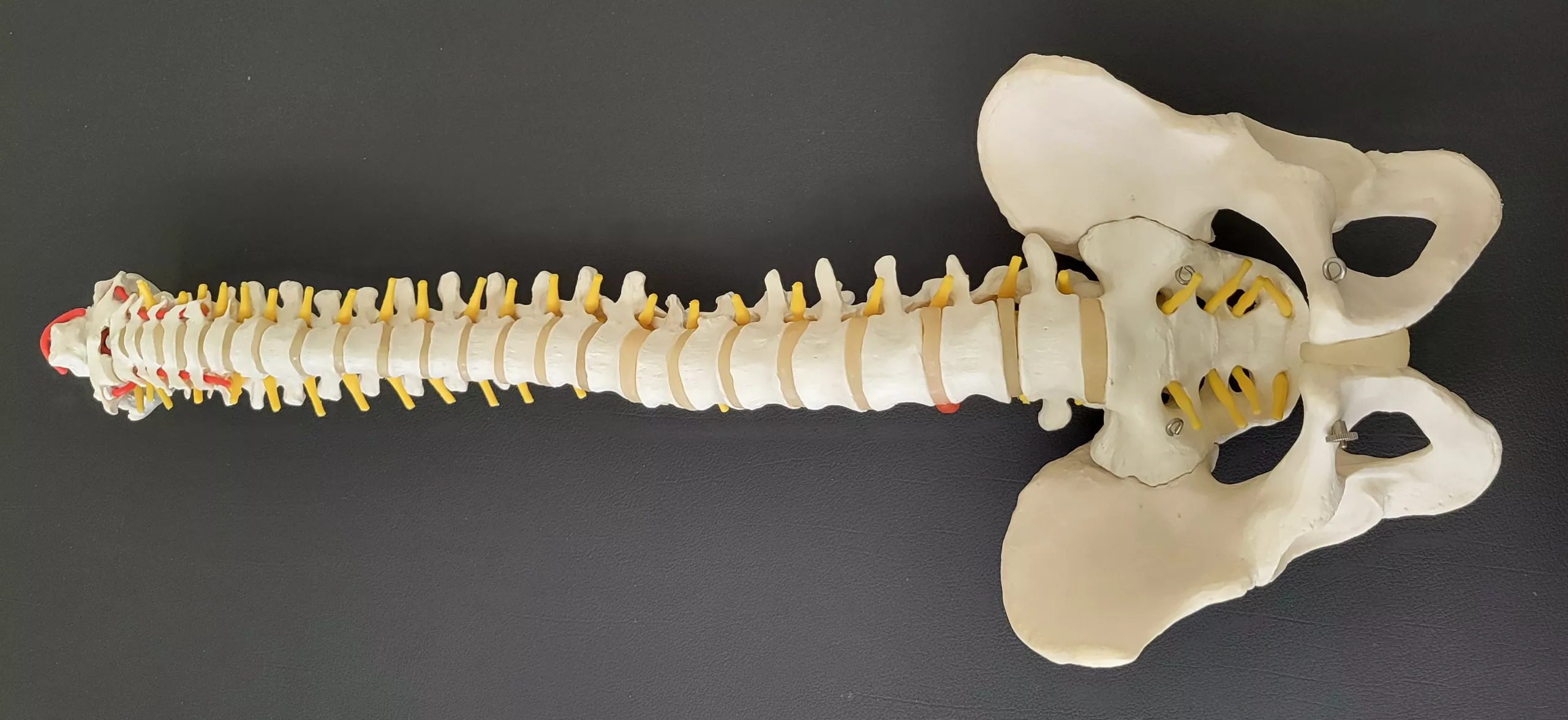 Traumatología Regenerativa, Medicina Regenerativa, Traumatologia y Ortopedia sin Cirugia, Artrosis, Dolor crónico de columna, Tendinitis calcificada, Tratamiento con Acido Hialuronico, Epicondilitis , Meniscopatía,Lumbalgia, Ciática